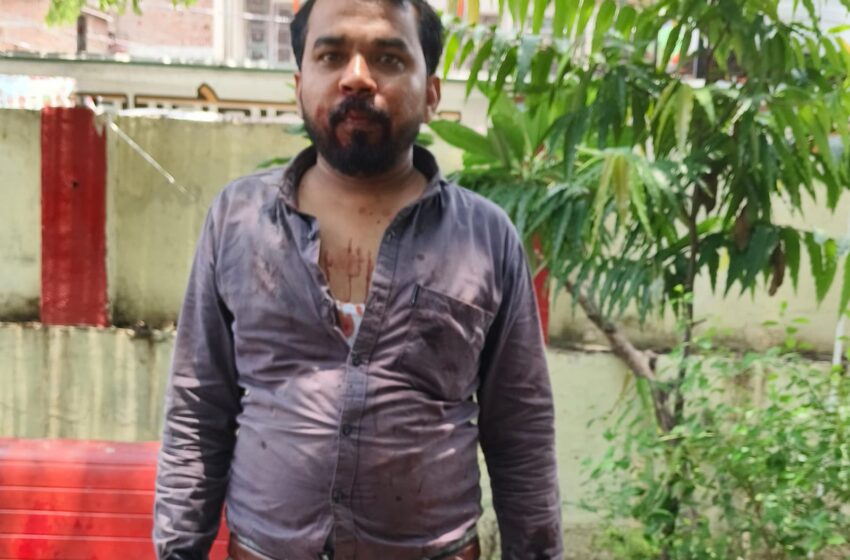  कम पेट्रोल की शिकायत पर पेट्रोल पंप संचालकों ने युवक को मारपीट कर किया लहूलुहान,छीना मोबाइल…।।